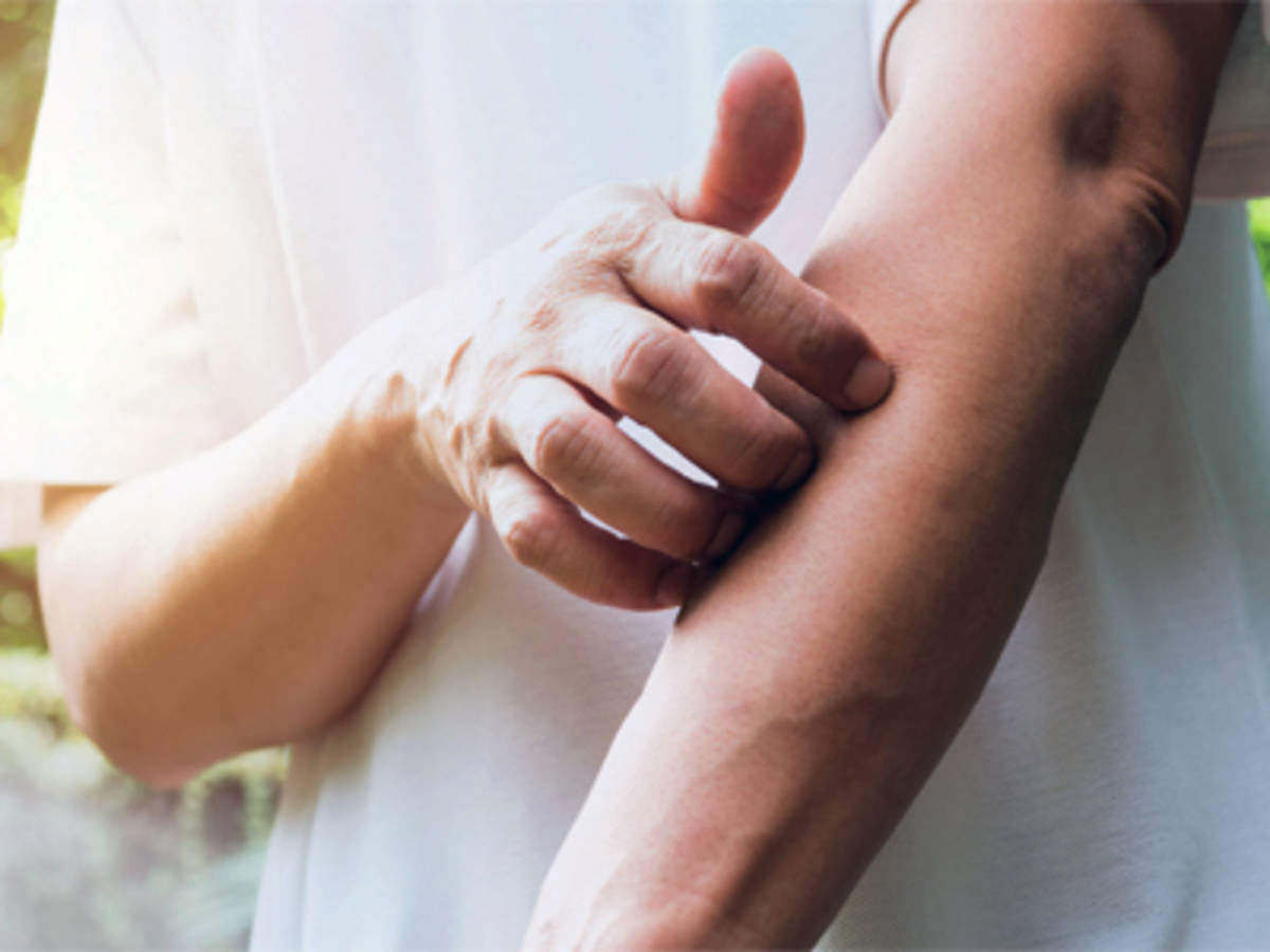 ​ऐलर्जी होने का खतरा